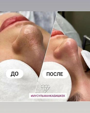 Косметология: Косметология, Чистка кожи, Массаж лица, Лечение угревой болезни, С выездом на дом, Сертифицированный косметолог, Консультация — 4