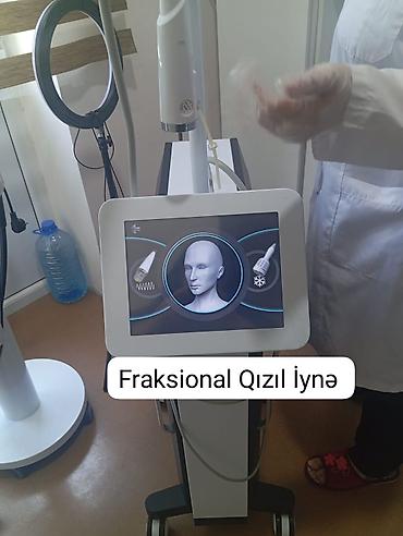 xbox one fat: Fraksional Qızıl İynə aparatı ilə professional dəri cavanlaşdırma — 1