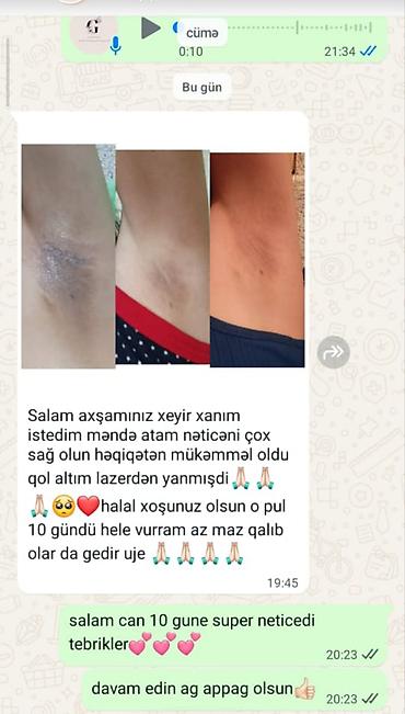 d3 nar qiymeti: Qolaltı qaralma və ləkələr üçün ağardırıcı baxım seti Məhsulun — 5
