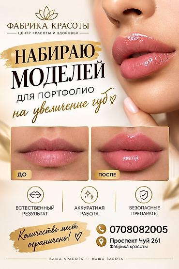 Красота и здоровье: Контурная пластика губ гиалуроновым филлером. - Цель: увеличение — 6