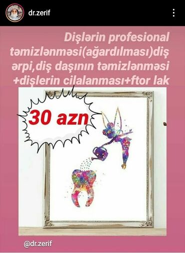 aqlay daşlarının qiyməti in Azərbaycan | DIGƏR TIKINTI XIDMƏTLƏRI: Stomatologiya | Diş daşlarının təmizlənməsi