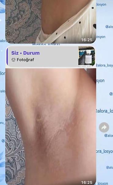 qara rəng: Alora Beauty – qaralıq və ləkələrə qarşı qabıqlanma effekti ilə baxım — 10