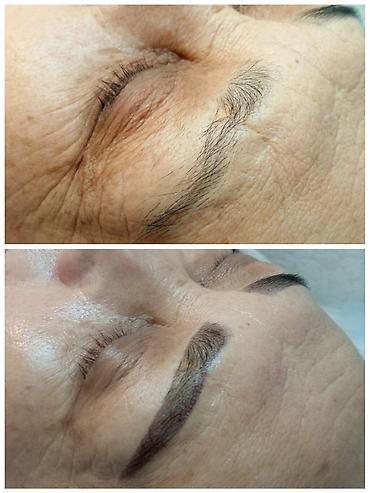 Другие услуги в сфере красоты и здоровья: Тридинг лица Тридинг — 6