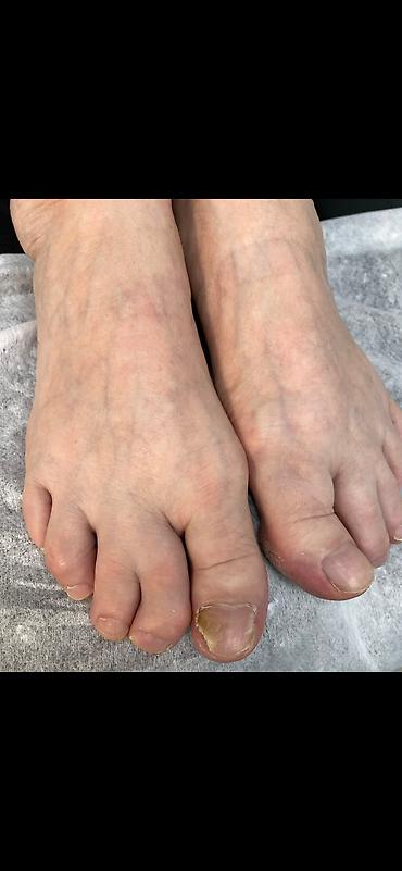 Маникюр, педикюр: Коррекция вросших ногтей, Услуги подолога, С выездом на дом, Консультация, Одноразовые расходные материалы — 3