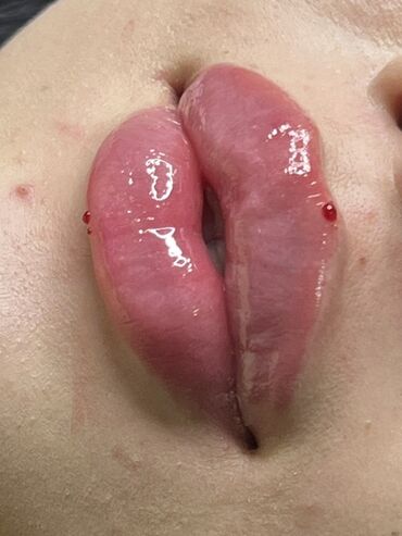 Косметика: Процедура перманентного макияжа губ позволяет придать губам желаемый — 22