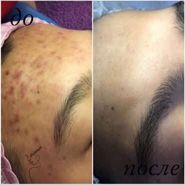 Косметология: Косметология, Чистка кожи, Биоревитализация, Пилинг, Сертифицированный косметолог, Гипоаллергенные материалы, Консультация — 2