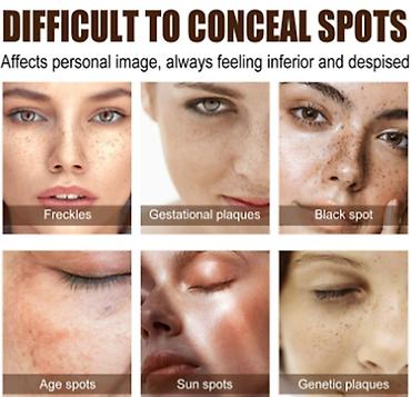 Уход за телом: США Крем интенсивное отбеливание удаление темных пятен веснушек и — 8