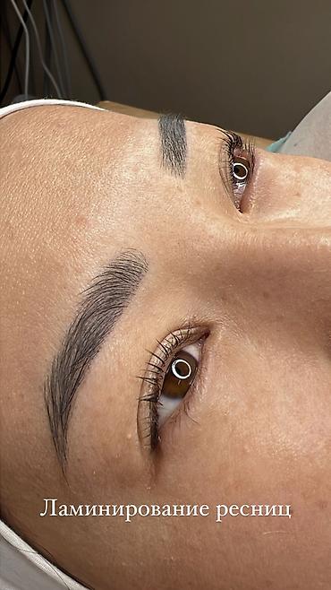 Косметология: Косметология, Ботокс, Биоревитализация, Ботулинотерапия, Консультация, Гипоаллергенные материалы, Сертифицированный косметолог at lalafo.kg — 17 Косметология: Косметология, Ботокс, Биоревитализация, Ботулинотерапия, Консультация, Гипоаллергенные материалы, Сертифицированный косметолог — 17