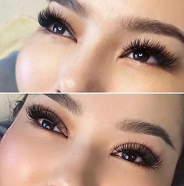 Косметология: Жип менен сурма чыгарабыз, операциясыз, кесилбейт, Оорубайт, шрам — 10