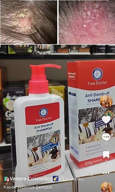 Gözəllik və sağlamlıq: Buyur, seboriya və kəpəye qarsi sampun 1. “Kəpəyə son — sağlam və — 1