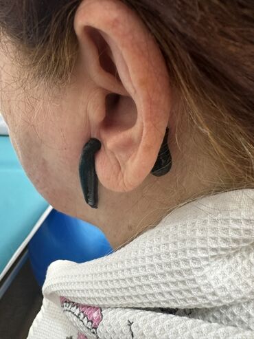 Hicama, zəli: Xidmət: Kupa terapiyası (quru və yaş/hicama), bel–boyun–çiyin masajı — 19