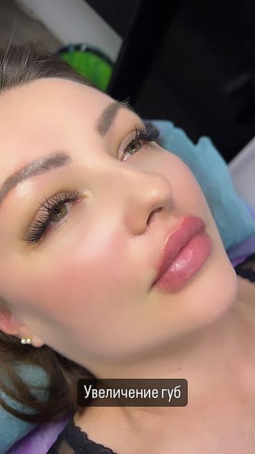 Косметология: Косметология, Ботокс, Биоревитализация, Ботулинотерапия, Консультация, Гипоаллергенные материалы, Сертифицированный косметолог at lalafo.kg — 35 Косметология: Косметология, Ботокс, Биоревитализация, Ботулинотерапия, Консультация, Гипоаллергенные материалы, Сертифицированный косметолог — 35