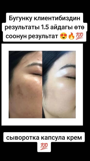 Косметика: Так,сепкил,куперез и бырышка 👍🔥Самый эффективный сыворотка крем 💯