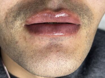 Косметология: Косметология, Ботокс, Биоревитализация, Ботулинотерапия, Консультация, Гипоаллергенные материалы, Сертифицированный косметолог — 24