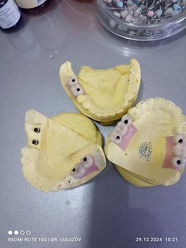 Медицинские услуги: Клиника | Стоматолог | Протезирование — 8