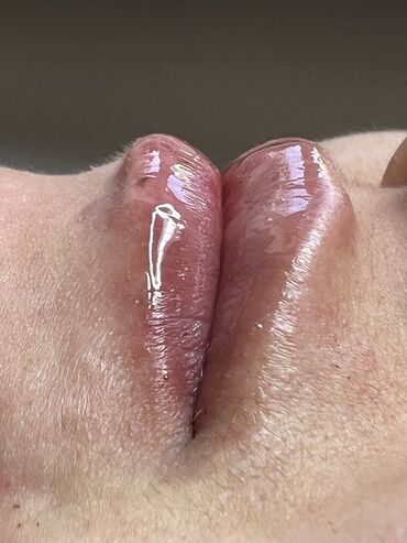 Косметология: Косметология, Маски, Мезотерапия, Удаление носогубных складок, Гипоаллергенные материалы, Консультация, Сертифицированный косметолог — 83