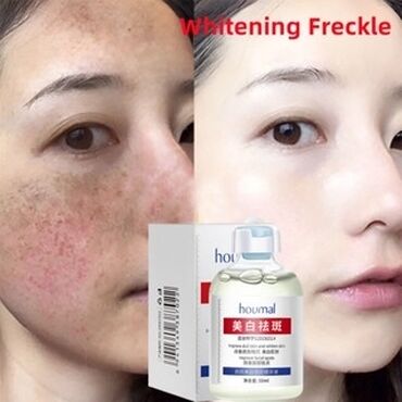 Косметика: От пигментации От пигментных пятен От веснушек Эссенция, поглощающая — 6