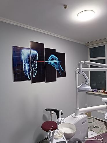 Побелка: Наружная побелка, Побелка потолков, Побелка стен | Мелковая побелка Больше 6 лет опыта — 2