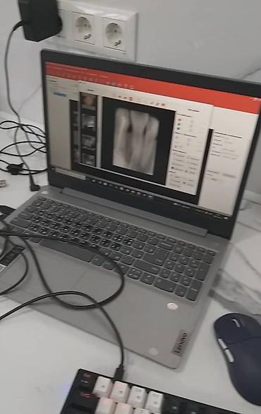 Медицинское оборудование: Рентген-аппараты стоматологические портативные Soft Ray, 2 модели в — 8