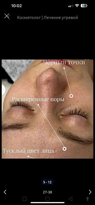 Косметология: Косметология, Маски, Мезотерапия, Удаление носогубных складок, Гипоаллергенные материалы, Консультация, Сертифицированный косметолог — 41