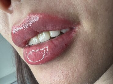 Косметология: Косметология, Ботокс, Биоревитализация, Ботулинотерапия, Консультация, Гипоаллергенные материалы, Сертифицированный косметолог — 51