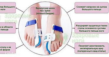 joint pro: Пальцевая шина hav splint — это единственный фиксатор, обладающий — 2