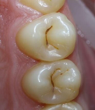 Stomatologiya: Stomatoloq Dr. Feyruz Dadaşovun fərdi praktikadasında böyüklərin və — 5