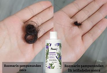 herbalife məhsulları: Homm bitkisel mehsullarından 100 azn alan xanımlara 20 azn pul — 1