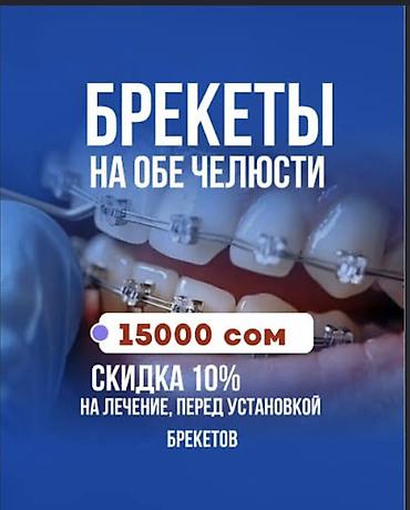 установка брекет: Услуга: установка брекет‑системы на обе челюсти. - Акция: стоимость — 4