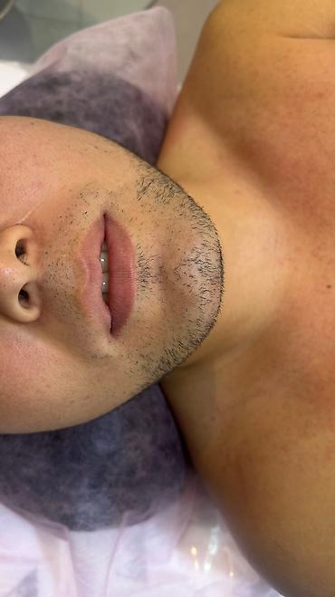 Эпиляция: Мужской шугаринг. Восковая депиляция — 5