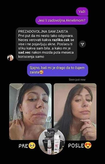 Nega kože: Aknelim gel 30ml – 100% delotvoran saveznik protiv akni Iskoristite — 4