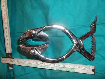 Ostali medicinski proizvodi: Automatski ekarteri II
Kao sa slika
Ne odgovaram na SMS — 25