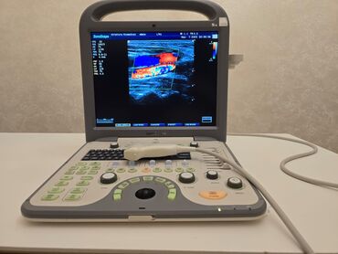 stomatoloji avadanliqlar: SonoScape S8 portativ USM aparatı Xüsusiyyətlər: - Rəngli Doppler