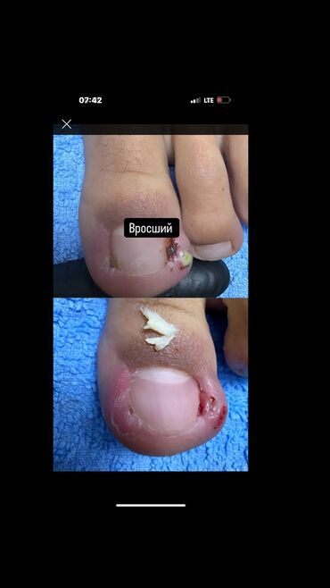 маникюр педикюр с выездом на дом: Выравнивание, Услуги подолога, Консультация, Одноразовые расходные материалы