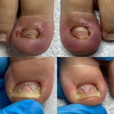 Маникюр, педикюр: Ремонт сломаных ногтей, Снятие, Укрепление ногтей, Услуги подолога, Одноразовые расходные материалы, Консультация, С выездом на дом — 2