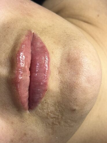 Косметология: Косметология, Маски, Мезотерапия, Удаление носогубных складок, Гипоаллергенные материалы, Консультация, Сертифицированный косметолог — 5