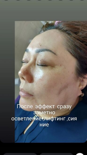 Косметология: Косметолог с медицинским образованием чистка лица пилинг осветление — 14