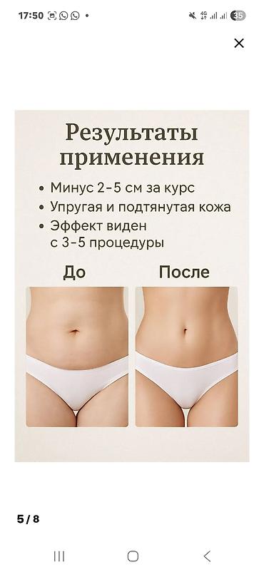 Тиричилик техникасы: Аппарат KIM8 для кавитации, RF-лифтинга и вакуумного массажа — 4