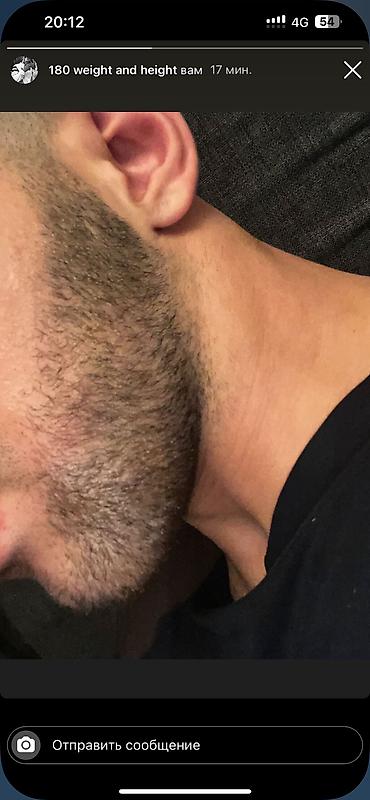 Уход за телом: Рост борода и волосы Миноксидил ультра 15% оригинал✅из Турции🇹🇷 — 4