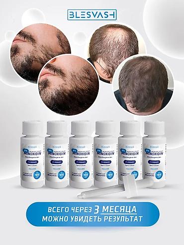 Медтовары: Minoxidin (Миноксидил 5%) для роста волос и бороды ака Киркланд — 4