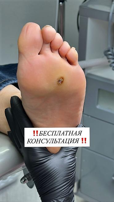 масаж для ног: Педикюр, С выездом на дом, Консультация, Одноразовые расходные материалы — 1