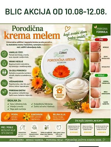 Nega kože: Nemojte ići na plažu bez ove kreme 🤗 🌿 PORODIČNA KREMA – melem koji — 15