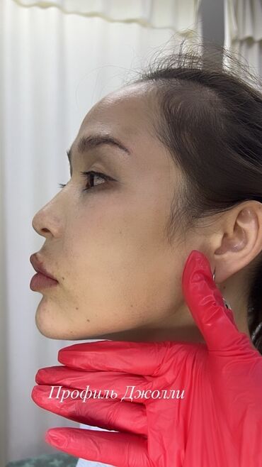 Косметология: Косметология, Маски, Мезотерапия, Удаление носогубных складок, Гипоаллергенные материалы, Консультация, Сертифицированный косметолог — 21