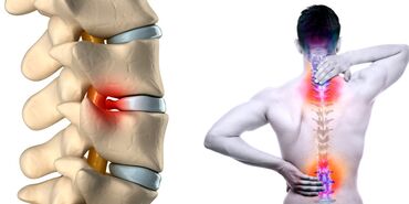 Уход за телом: Бишофит от чего помогает. опорно-двигательного аппарата — 7