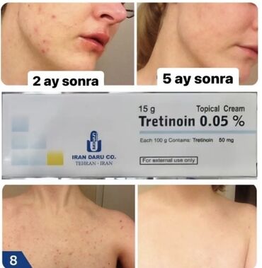 multivitamin qiyməti: Üz kremi, Problemli dəri üçün, 20 ml, Yeni, Ödənişli çatdırılma