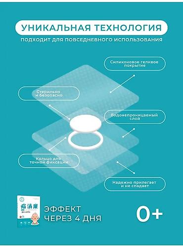 сына: Пластырь от пупочной грыжи, в упаковке 9 пластырей. (гипоаллергенный — 6