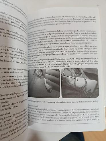 Knjige: Terapija bola – Priručnik (VMA) Stručno izdanje posvećeno savremenim — 7