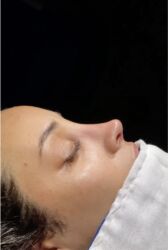 Digər gözəllik və estetika cihazları: Plastik estetik hər yüksək səviyyə uyğun qiymət!!!Burdan mesaj — 3