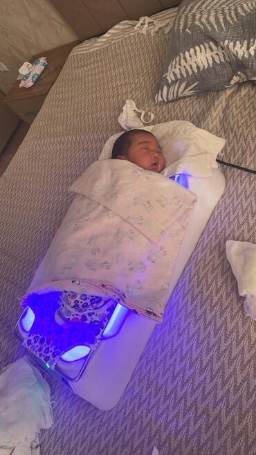 фотолампа от желтушки для новорожденных: Фотолампа от желтушки в виде ванночки нижнего свечения. Аренда