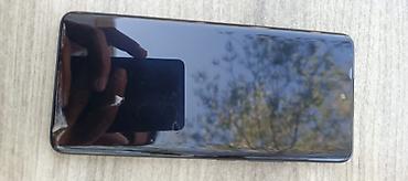honor 9 lite baku: Note 15 256 yaddaş vuruğu dəyişən detalı yoxdu usta əli deymiyib bir — 3